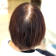 白髪ぞめ前の写真